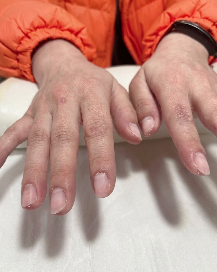 Primer plano de un aerógrafo rociando una fina bruma blanca sobre las puntas de las uñas cubiertas por plantillas moradas.