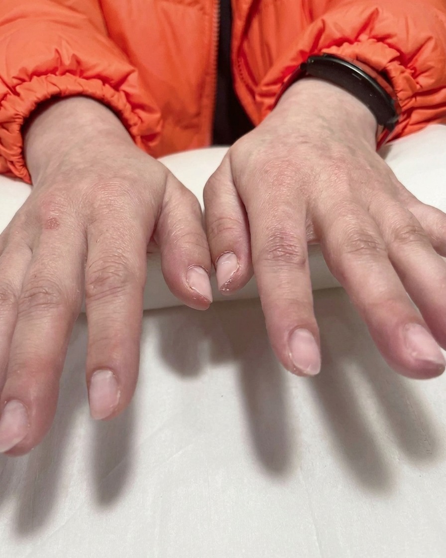 Primer plano de una mano con pinzas retirando cuidadosamente una plantilla morada de una uña, revelando una punta ombré blanca nítida.