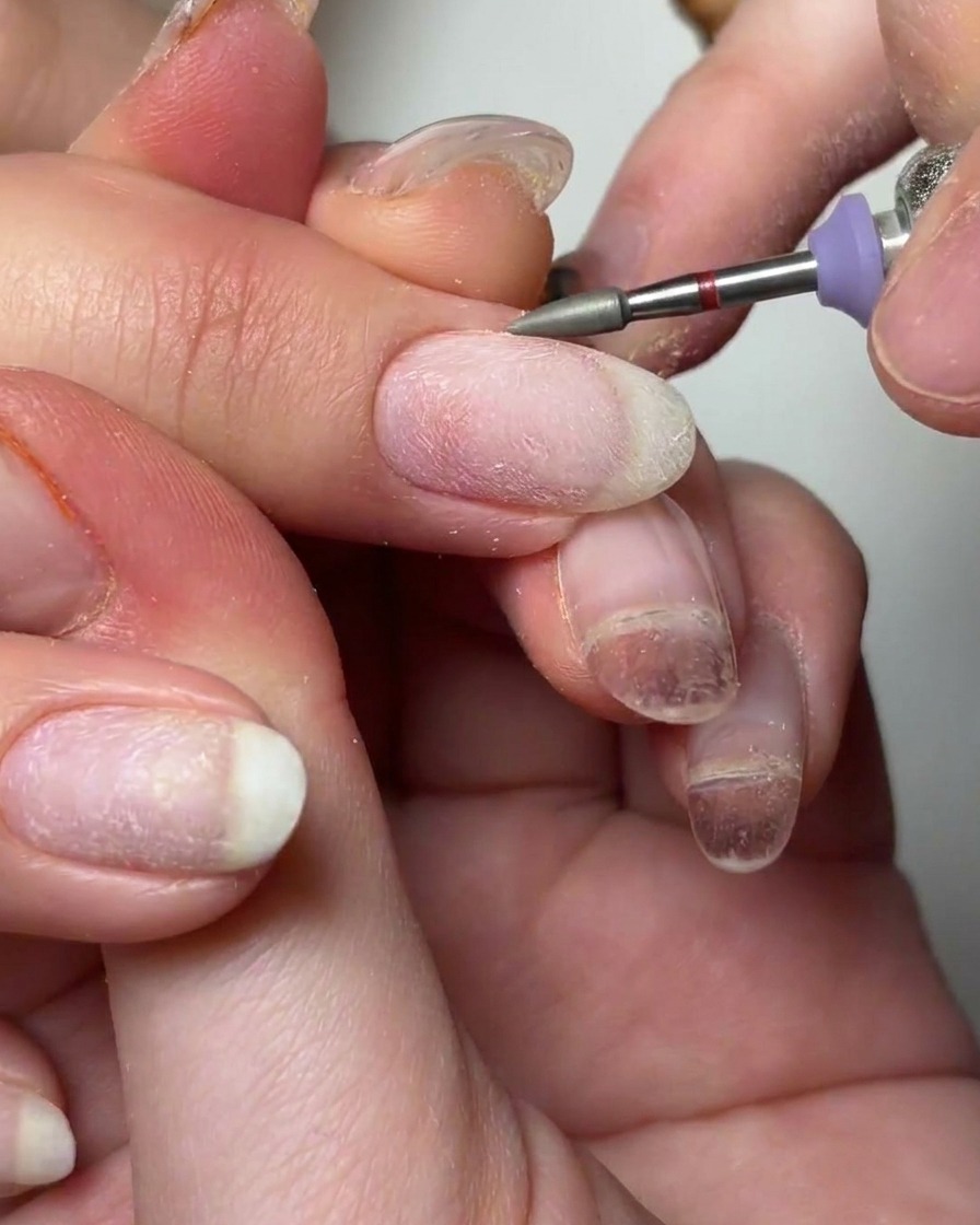 Una fresa en forma de cono siendo utilizada para limpiar alrededor del área de la cutícula con alcohol.