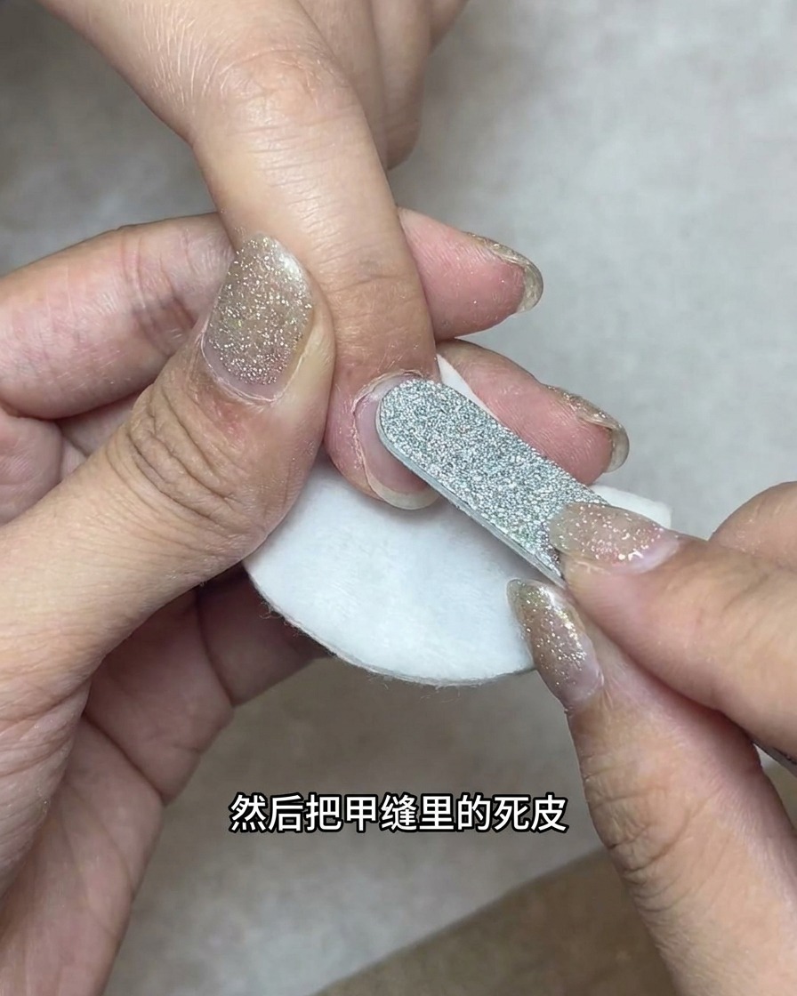 Un torno de uñas con una broca en forma de bala limpiando los pliegues laterales de la uña sobre un disco de algodón.