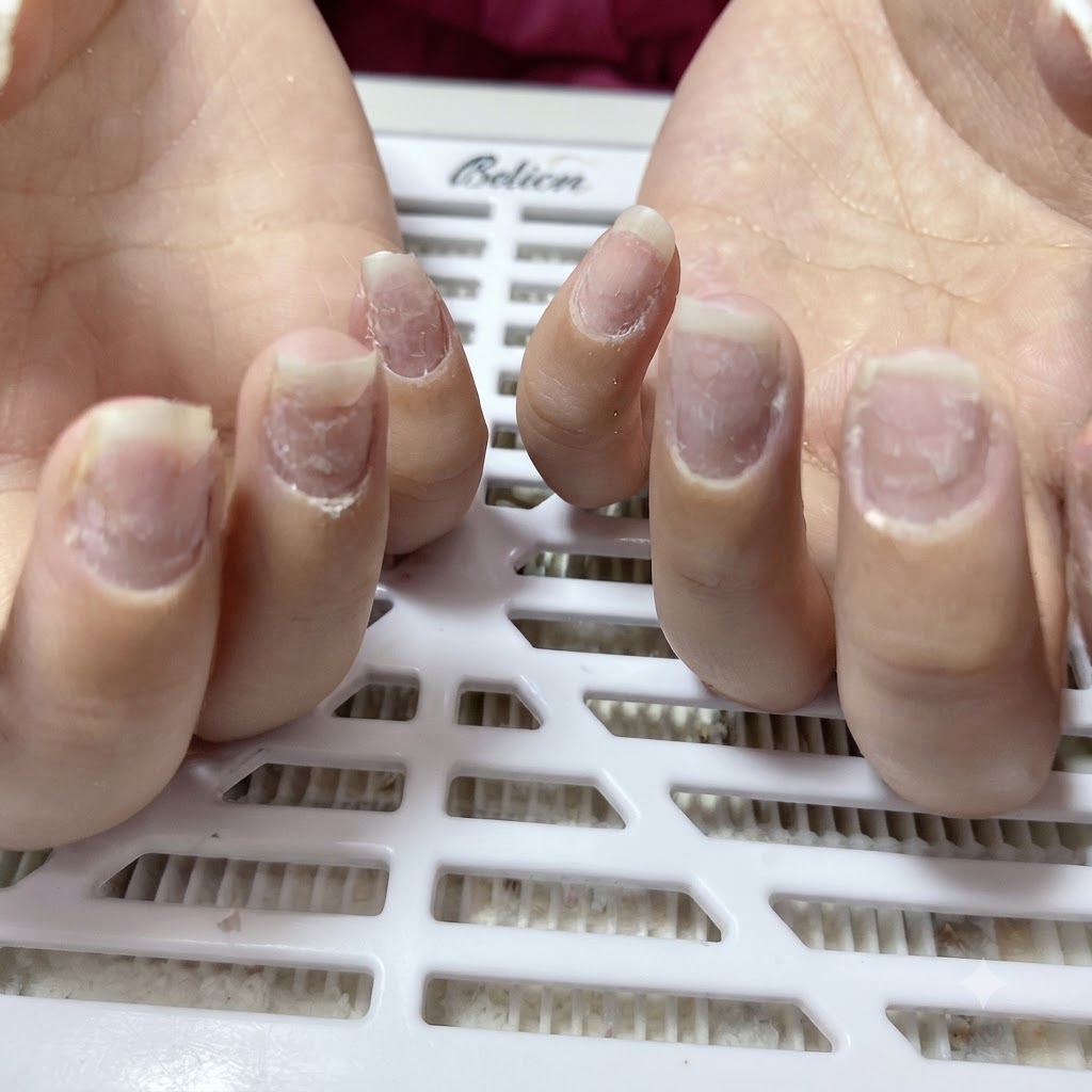 Primer plano de uñas naturales limadas en forma almendrada, con polvo de uñas blanco visible alrededor de las cutículas y los pliegues ungueales.